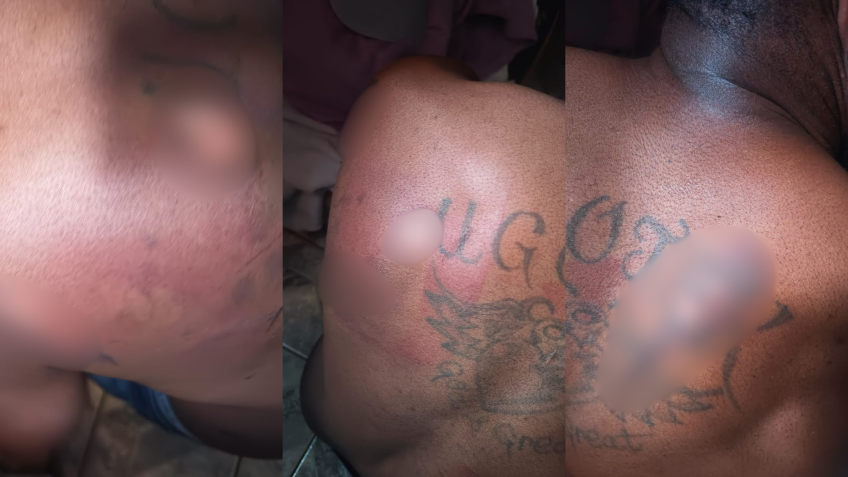 Emmanuel estava com ferimentos de agressões • Reprodução/Polícia Civil