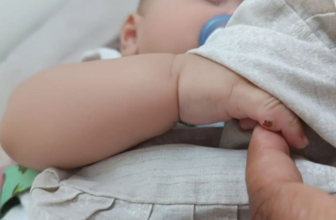 BEBÊ LÍNGUA OPERADA AO INVÉS DO DEDO