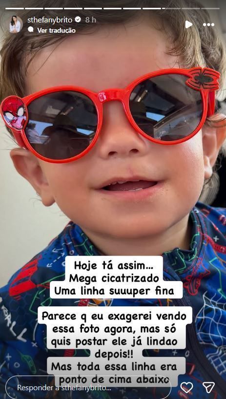 Sthefany Brito mostra cicatriz do filho • Instagram/Sthefany Brito