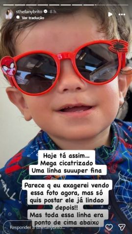 Sthefany Brito mostra cicatriz do filho • Instagram/Sthefany Brito