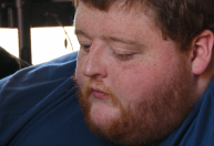 "Quilos Mortais": veja o antes e depois de Justin, que pesava 311 kg