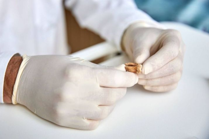 Um dente utilizado para análises de DNA antigo durante o estudo do exército de Napoleão • Cláudio Centonze/Comissão Europeia