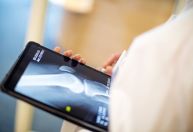 Casos de osteoporose devem disparar até 2050, inclusive no Brasil