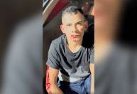 “Não conhecia”: preso diz que atropelou e arrastou mulher por engano em SP