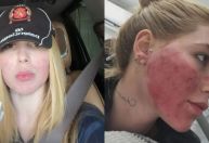 Virginia se arrepende de procedimento no rosto: "Tinha necessidade?"