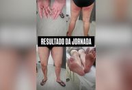 Irmã de jovem desaparecido em trilha posta foto de lesões do irmão; veja