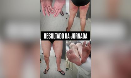 Irmã de jovem desaparecido em trilha posta foto de lesões do irmão; veja