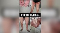 Irmã de jovem desaparecido em trilha posta foto de lesões do irmão; veja
