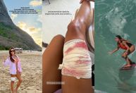 Turista é mordida por tubarão durante mergulho em Fernando de Noronha (PE)