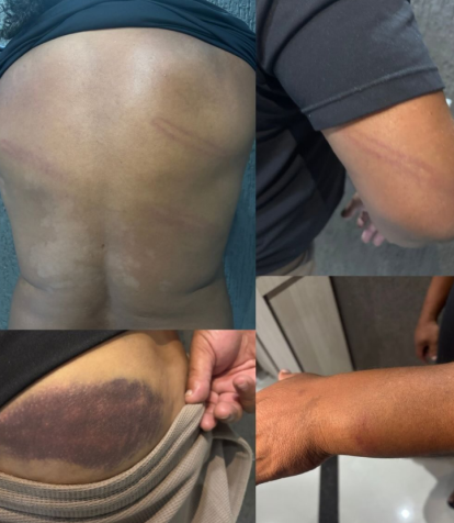 Ex-atleta relata agressão por PM no Paraná • Reprodução / Instagram