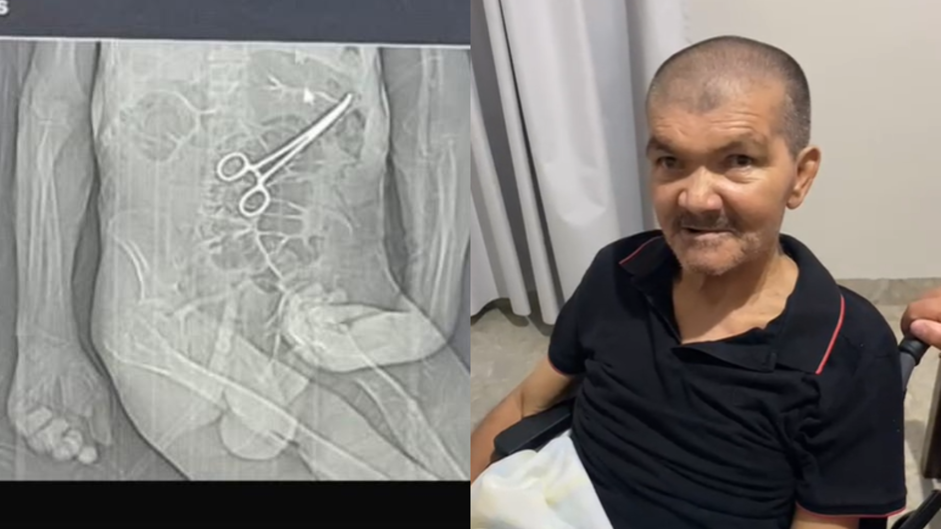 MORRE IDOSO PINÇA