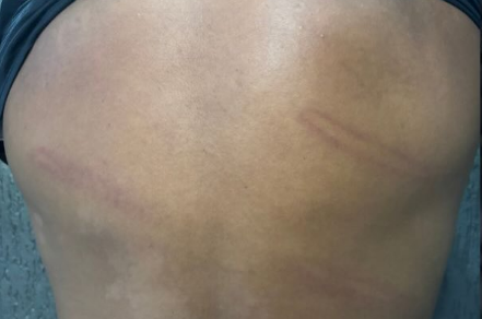 Perdigão publicou imagens do corpo após agressão por PM
