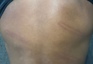 Campeão mundial pelo Inter publica fotos com hematomas após agressão por PM