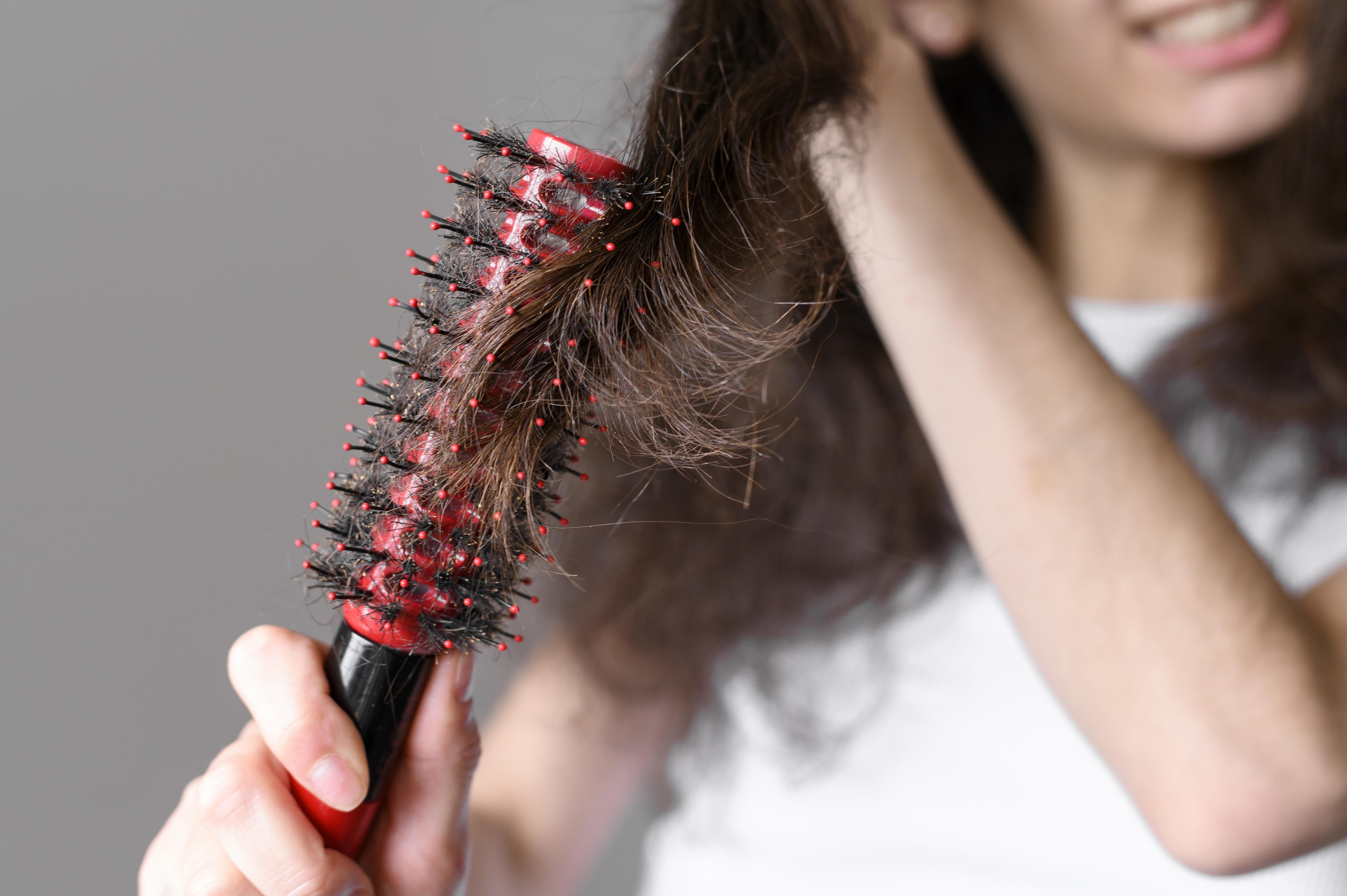 Queda de cabelo