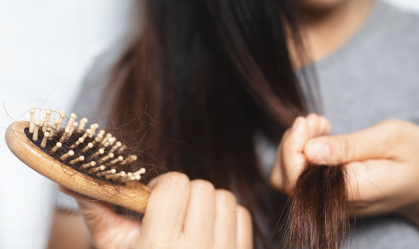 Queda de cabelo, entenda quando pode ser algo maior
