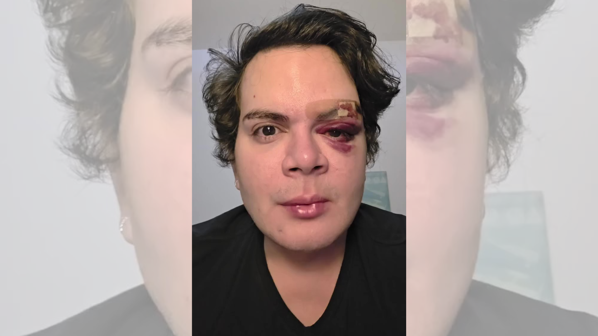 Médico denuncia agressão com homofobia dentro do próprio apartamento no Recife