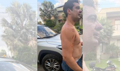 Morador denuncia agressão por atleta do Fortaleza em condomínio de luxo