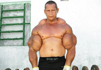 Arlindo Anomalia, o “Popeye brasileiro”, morre aos 55 anos | CNN Brasil