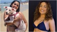 Camila Moura perde 40 kg e faz série de procedimentos; veja antes e depois
