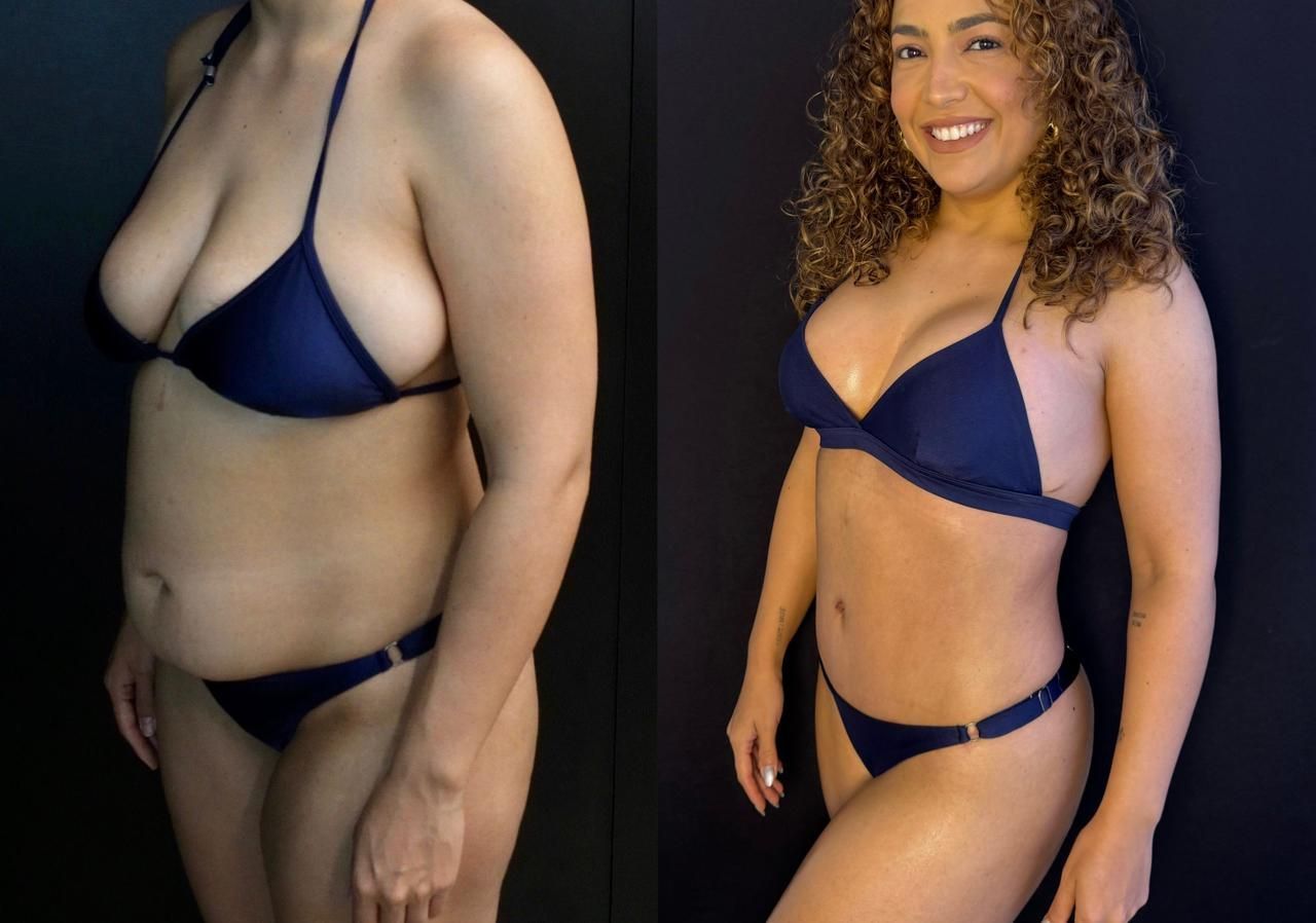Antes e depois de Camila Moura • Camila Moura