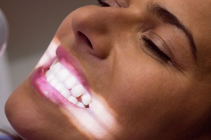 Anvisa determina proibição de fita para clareamento dental