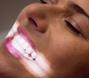 Anvisa determina proibição de fita para clareamento dental