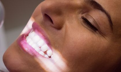 Anvisa determina proibição de fita para clareamento dental
