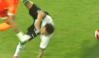Imagens fortes: atacante do Coritiba fratura o braço em jogo do Paranaense