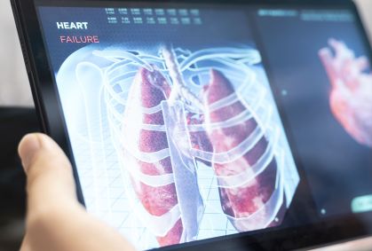 Paciente sobrevive 48 horas sem pulmões nos Estados Unidos; entenda