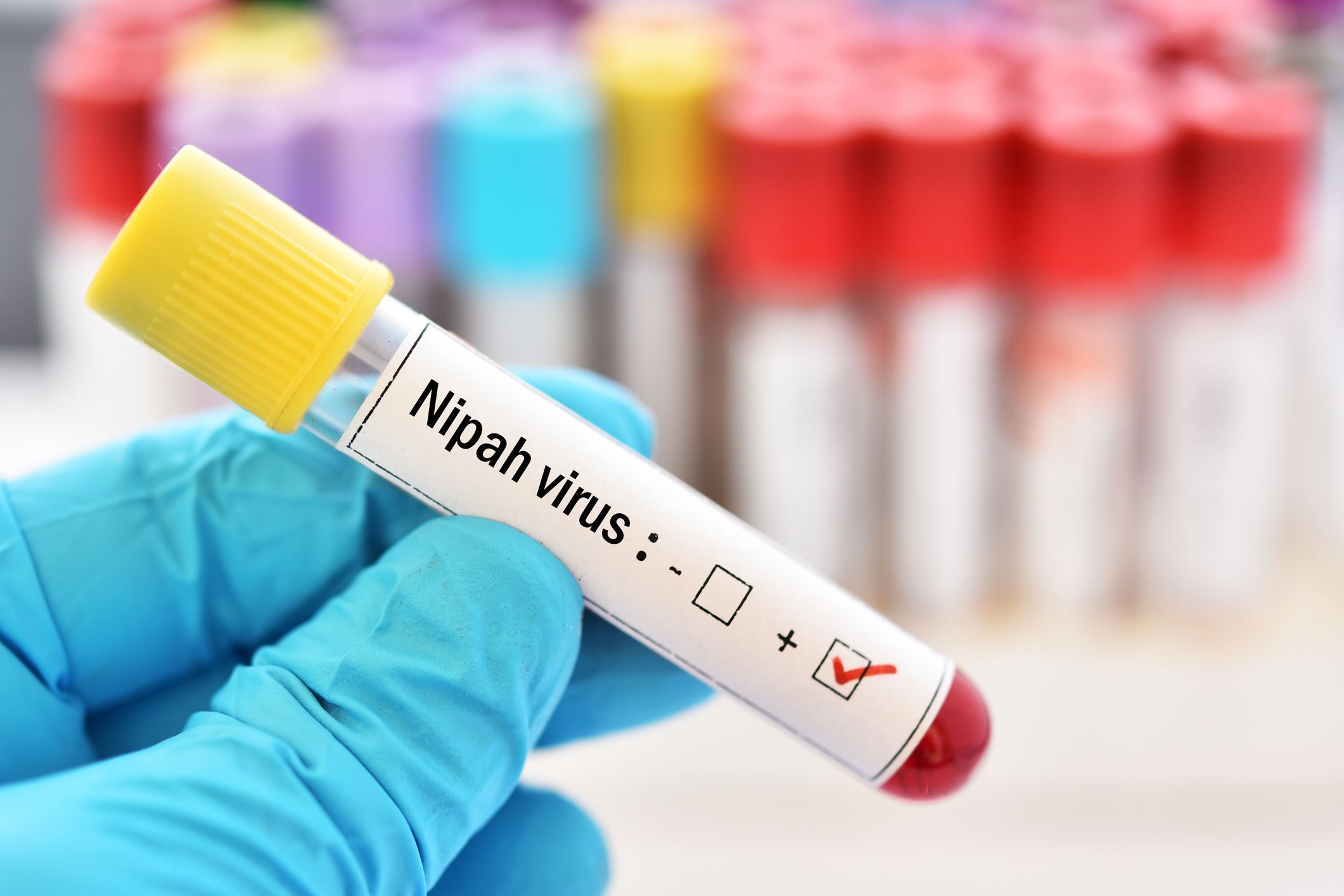 Nipah virus positive