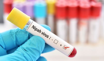 Vírus Nipah: tudo o que já se sabe sobre doença mortal