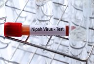 Vírus Nipah: o que se sabe sobre os casos detectados na Índia