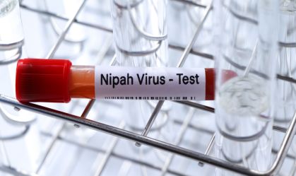 Vírus Nipah: taxa de mortalidade pode chegar a 75%