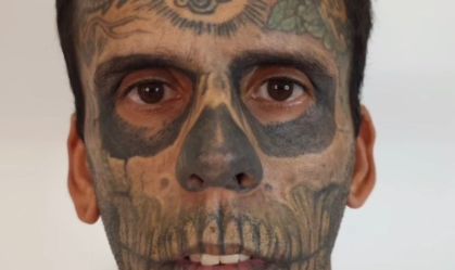 "Mais tatuado do Brasil" passa por nova remoção e fala em vida missionária