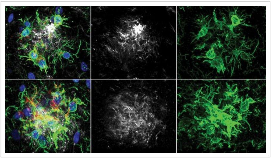 O Laboratório Tonks estudou a inibição da PTP1B em um modelo de camundongo com doença de Alzheimer