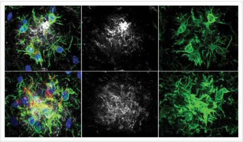O Laboratório Tonks estudou a inibição da PTP1B em um modelo de camundongo com doença de Alzheimer