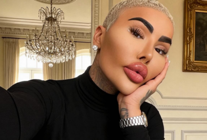 Influenciador e “Rei dos Lábios” morre após suposto procedimento estético