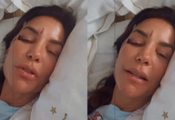 Ivete Sangalo aparece com rosto machucado e tranquiliza fãs após queda