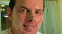 Marido de Gretchen, Esdras de Souza faz procedimento no nariz: "Feliz"