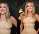 Heidi Klum mostra machucados causados por look usado no Grammy 2026