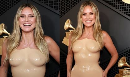 Heidi Klum mostra machucados causados por vestido de látex usado no Grammy