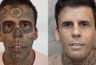 "Mais tatuado do Brasil" passa por nova remoção e fala em vida missionária