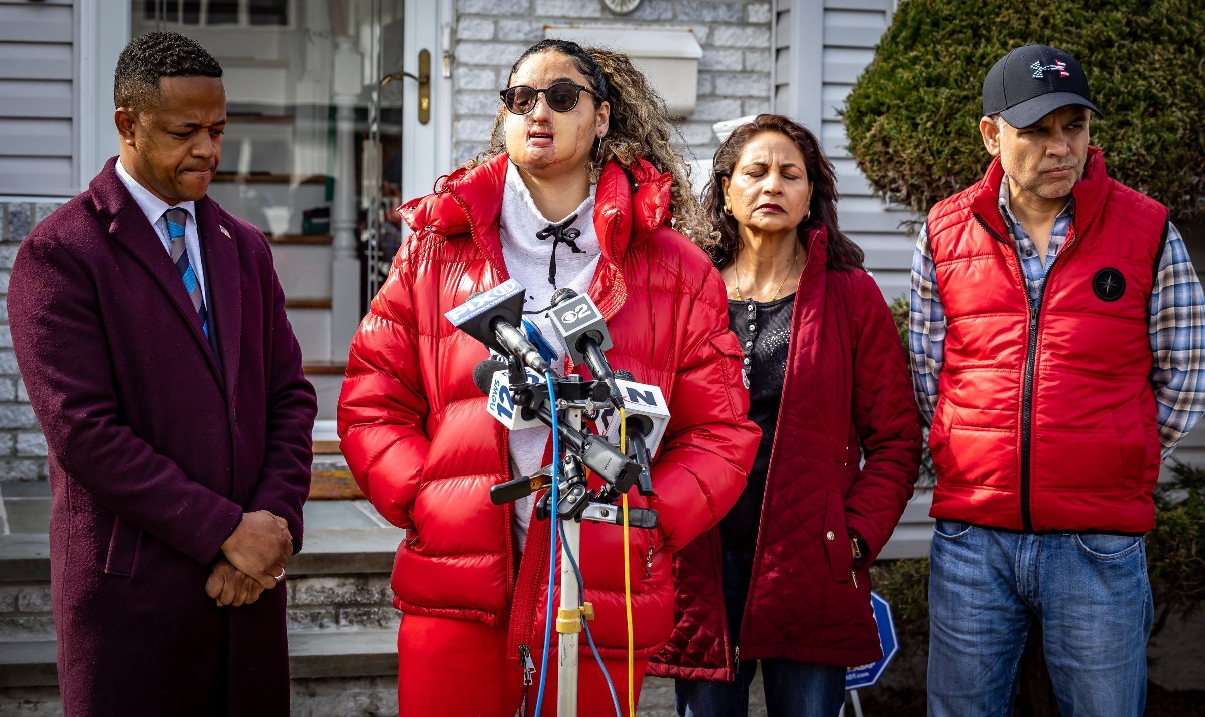 Nafiah Ikram, vítima de ataque com ácido em Long Island