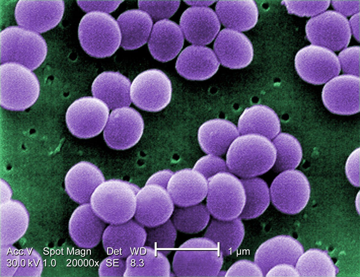 O spray nasal conseguiu combater o Staphylococcus aureus, uma das causas mais frequentes de infecções hospitalares • CDC/ Matthew J. Arduino, DRPH/Wikimedia Commons