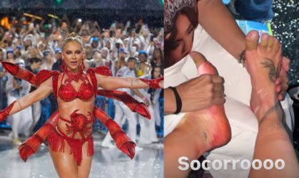 Virginia mostra os pés machucados após último ensaio na Marquês de Sapucaí
