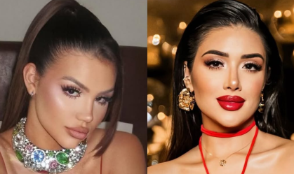 Juliano Floss vê semelhança entre ex e sister por procedimentos: "Trauma"