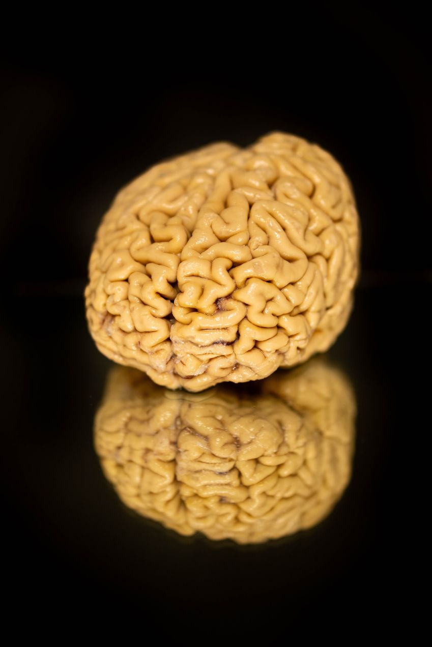 Um indivíduo "SuperIdoso" doou seu cérebro para pesquisa • De Shane Collins/Universidade Northwestern