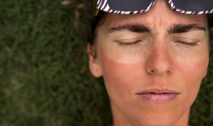 Como minimizar os danos da exposição solar acumulada?