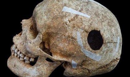 Descoberta macabra na Inglaterra revela mortes horríveis de 1200 anos