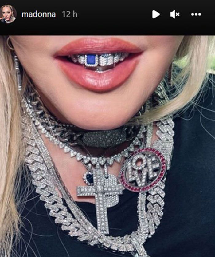 Madonna usa joia dental criada por artista brasileira